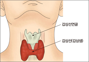 갑상선암 증상과 치료과정 및 갑상선암 식단