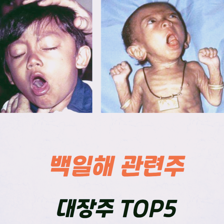 백일해 관련주 대장주 테마주 수혜주 TOP5