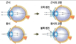 시력