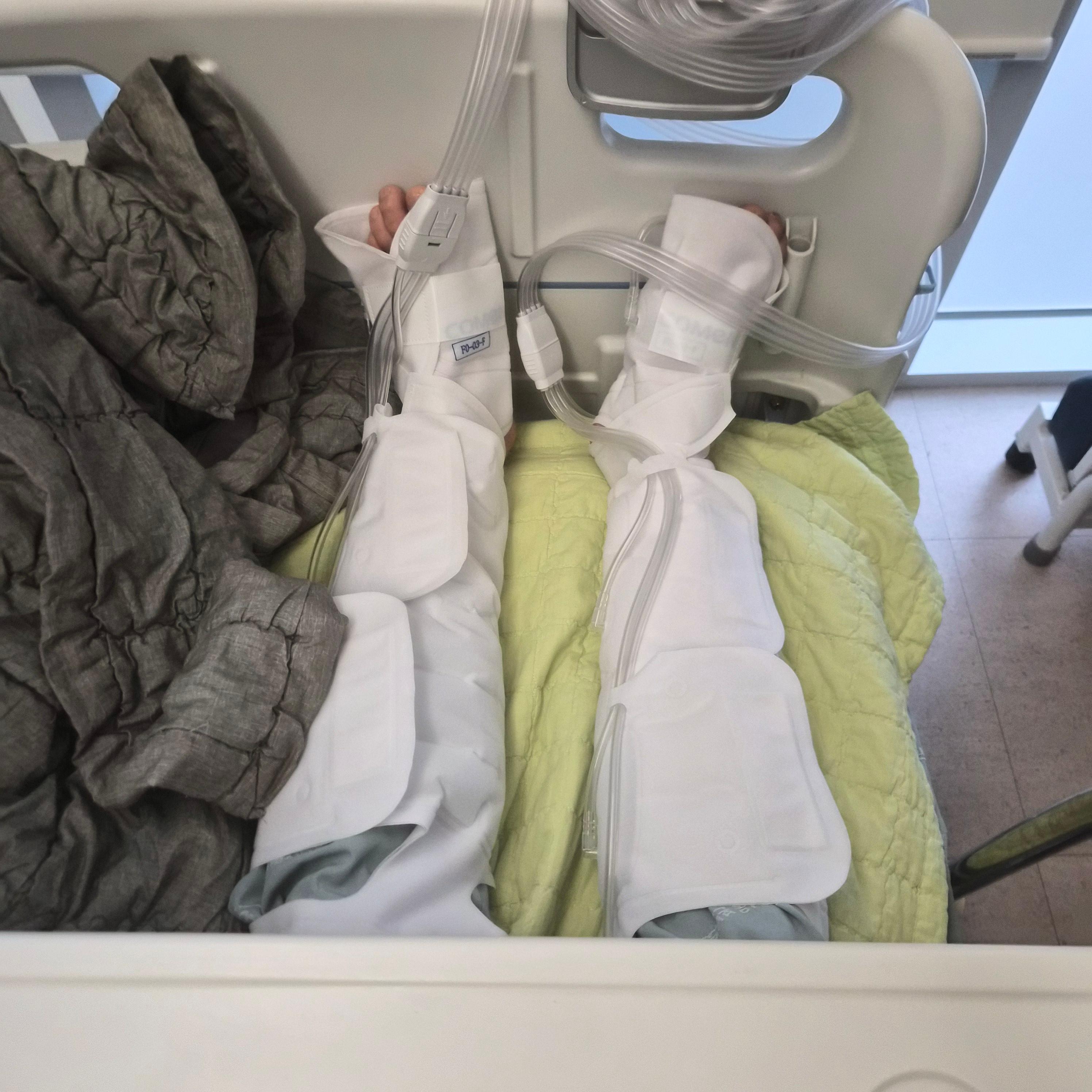 어깨 와순파열 봉합수술 후 mri사진 물리치료 기록