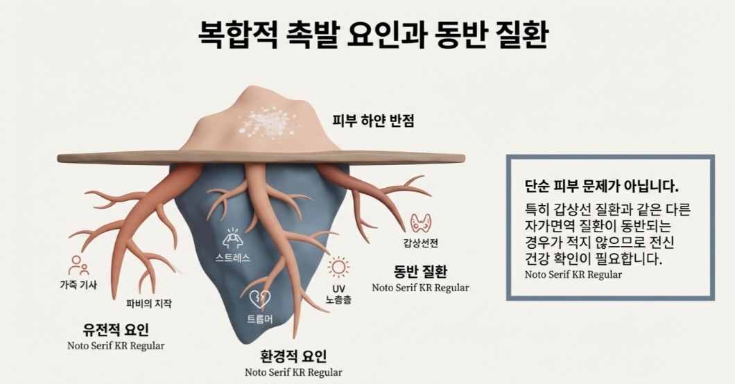 백반증원인-사진8