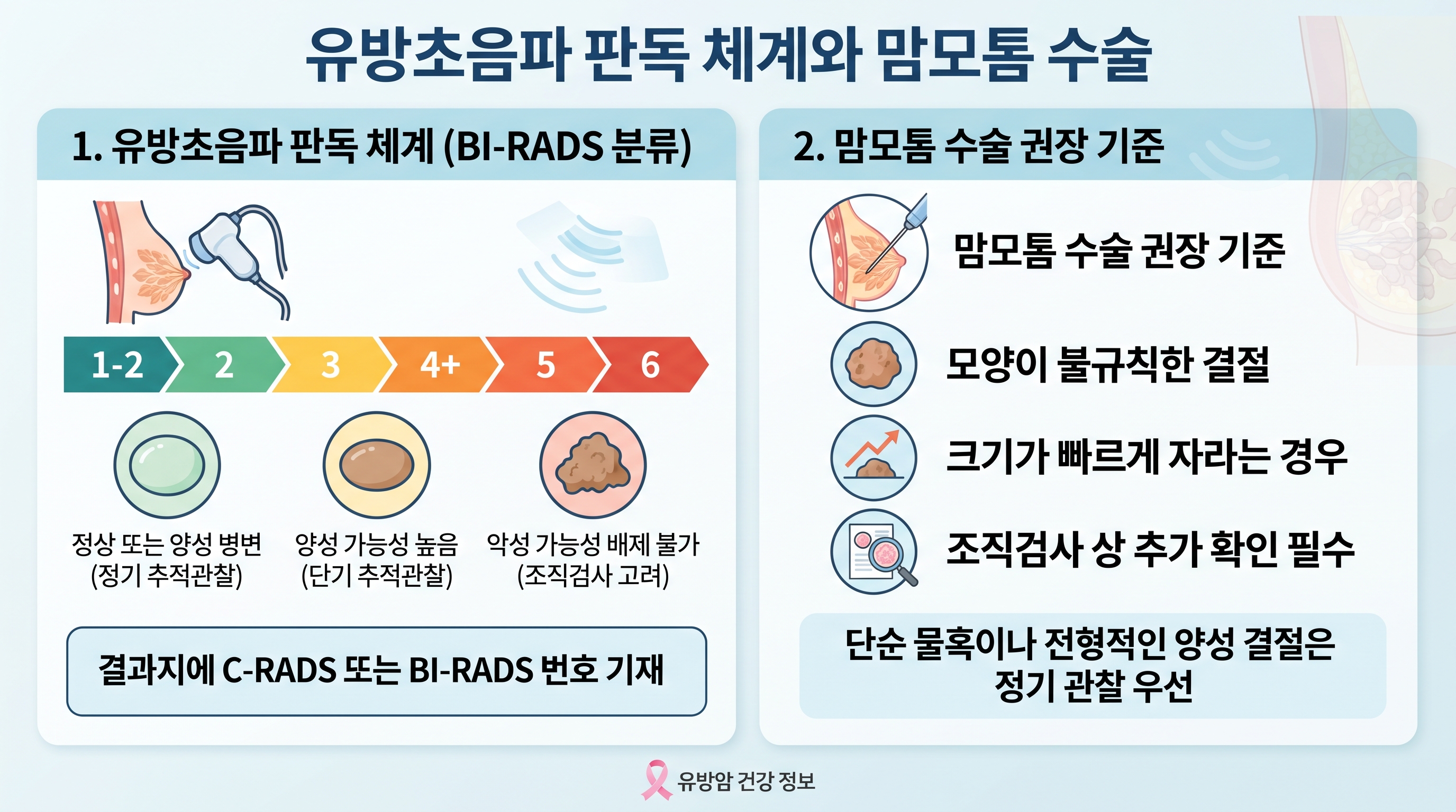 유방초음파 판독 체계인 BI-RADS 분류 단계와 맘모톰 수술 권장 기준을 정리한 인포그래픽