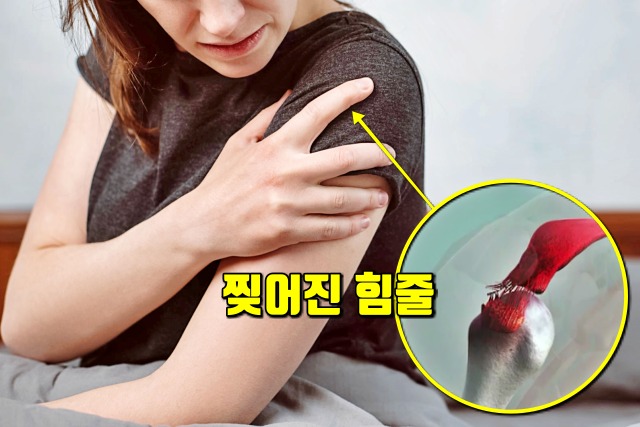 어깨통증 원인, 회전근개파열 증상 치료법 운동,건강 팁줌 매일꿀정보