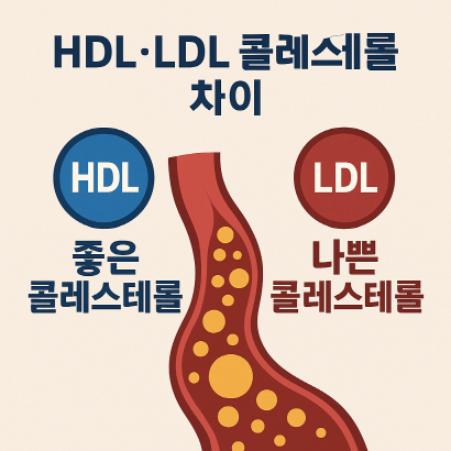 HDL과 LDL 완벽 정리! 콜레스테롤이 건강을 좌우한다