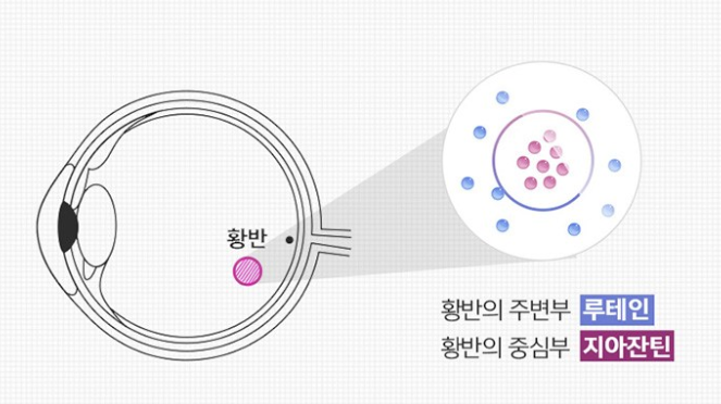 황반