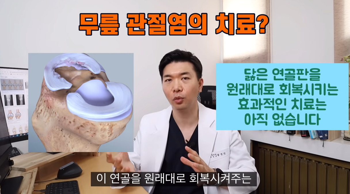 무릎 관절염 치료
