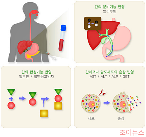 간 기능 검사_이미지출처:국가건강정보포털