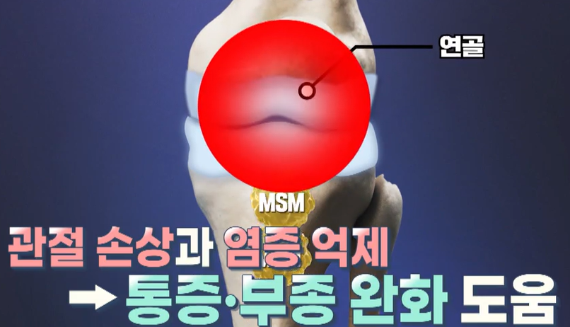 msm의 효능