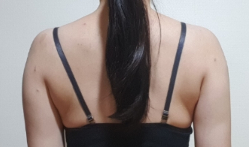 팔 람스 전후 내돈내산 후기