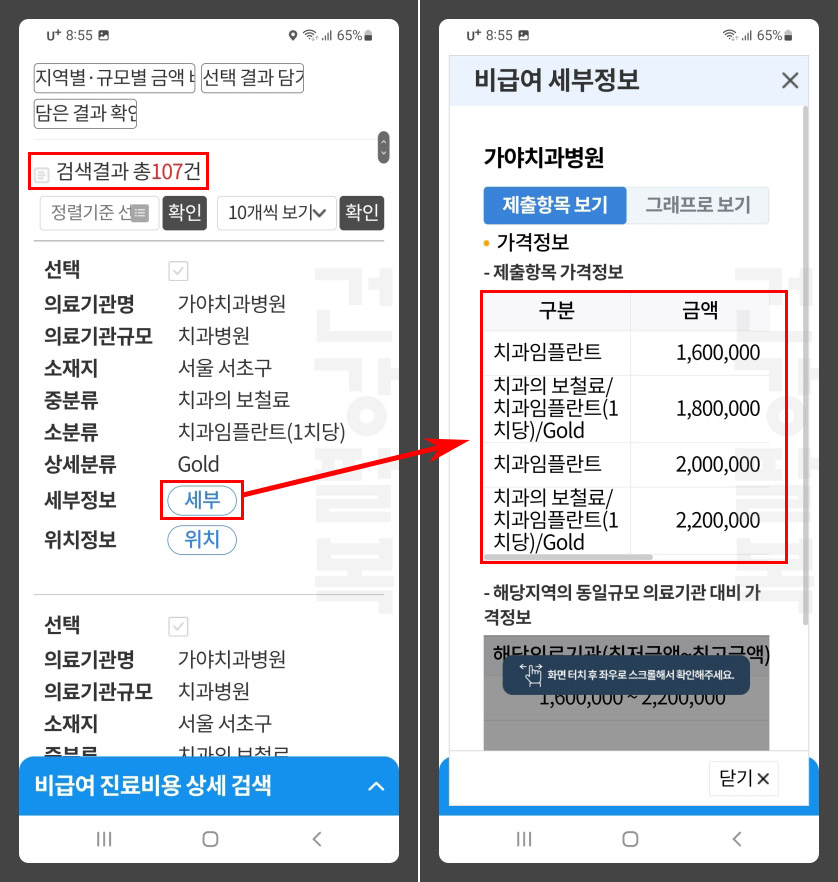 임플란트 가격 비교 사이트