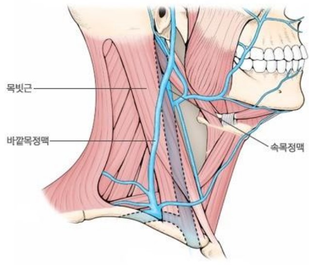 경정맥 위치 및 경동맥과의 차이점 &amp;#124; 경정맥 손상 후유증 &amp;#124; 이재명 대표 수술 상황