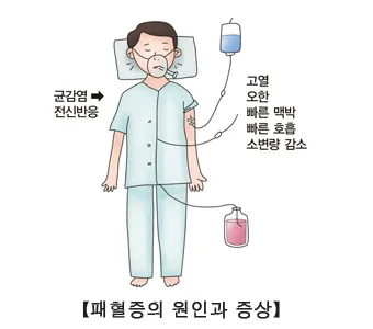 패혈증이란 무엇인지 원인 증상 치료 예방법_2