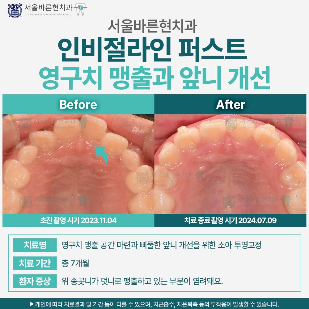 해운대인비절라퍼스트