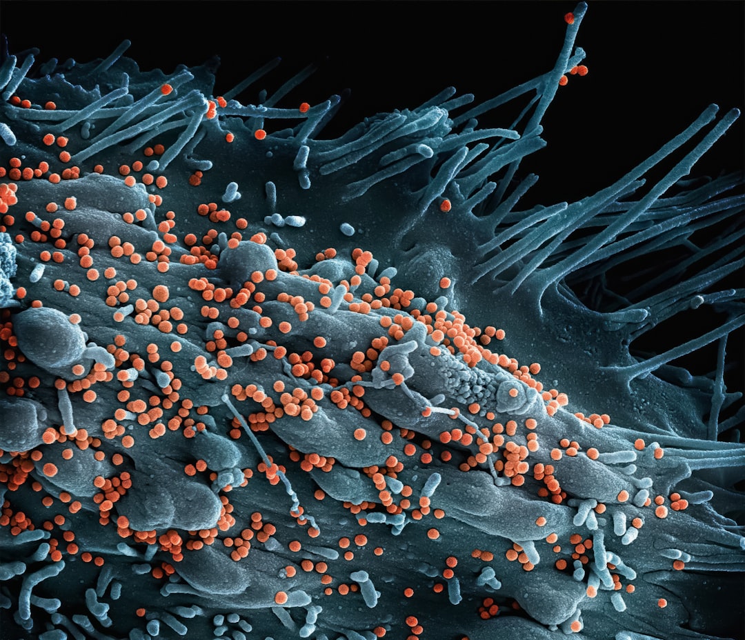 Measles