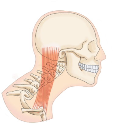 경추견인기 추천 목디스크 거북목 통증