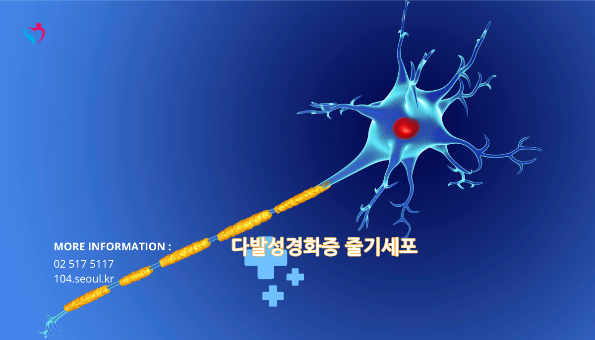 다발성경화증 줄기세포