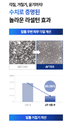 문제성 발톱 영양제 &amp;#39;라셀턴&amp;#39; 효과 있을까?