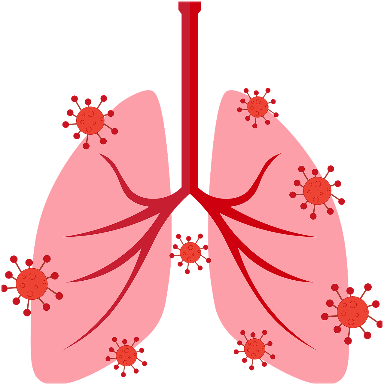 기관지 확장증 증상 원인 치료 관리 예방 방법