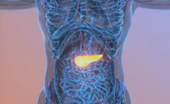 췌장암, 조기 발견이 어려운 이유는 무엇일까?