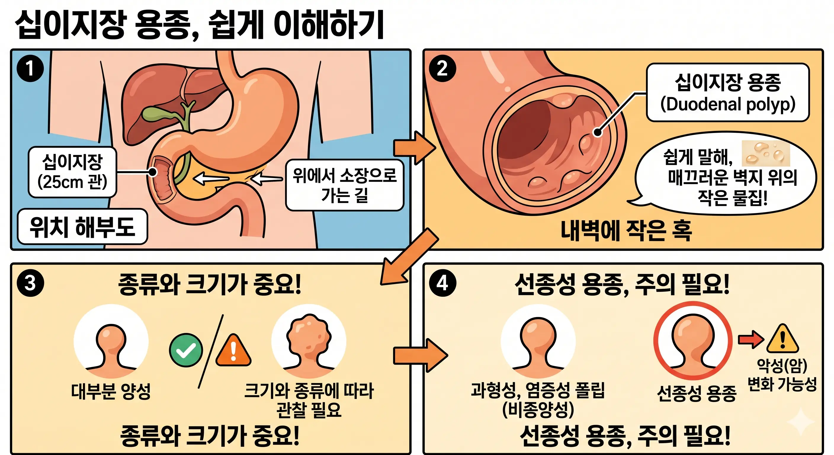 십이지장 용종