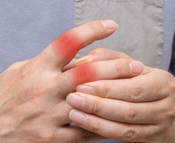 손가락 관절염 4