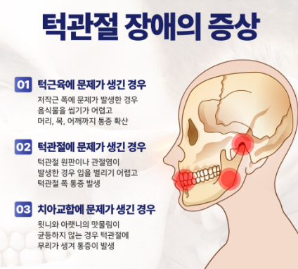 턱 관절 장애 분석 관련 사진