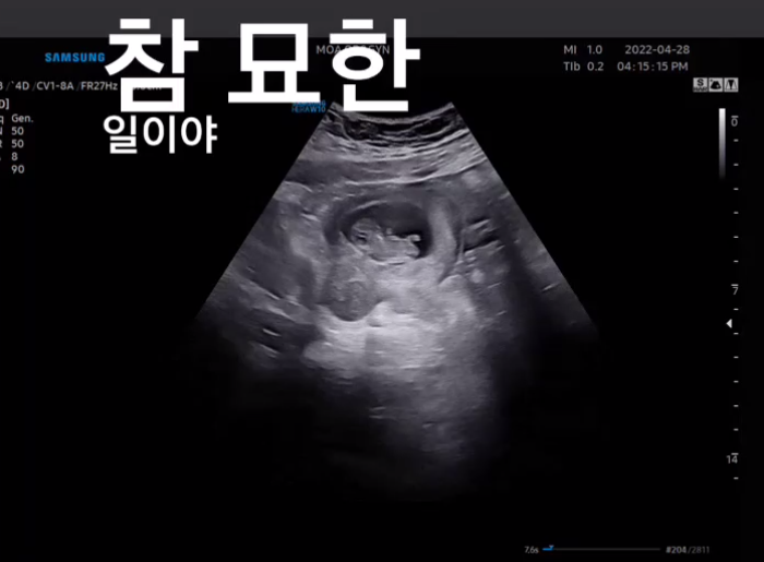 이재은 9주차