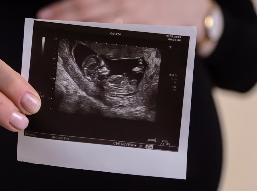 엽산 효능 : 태아