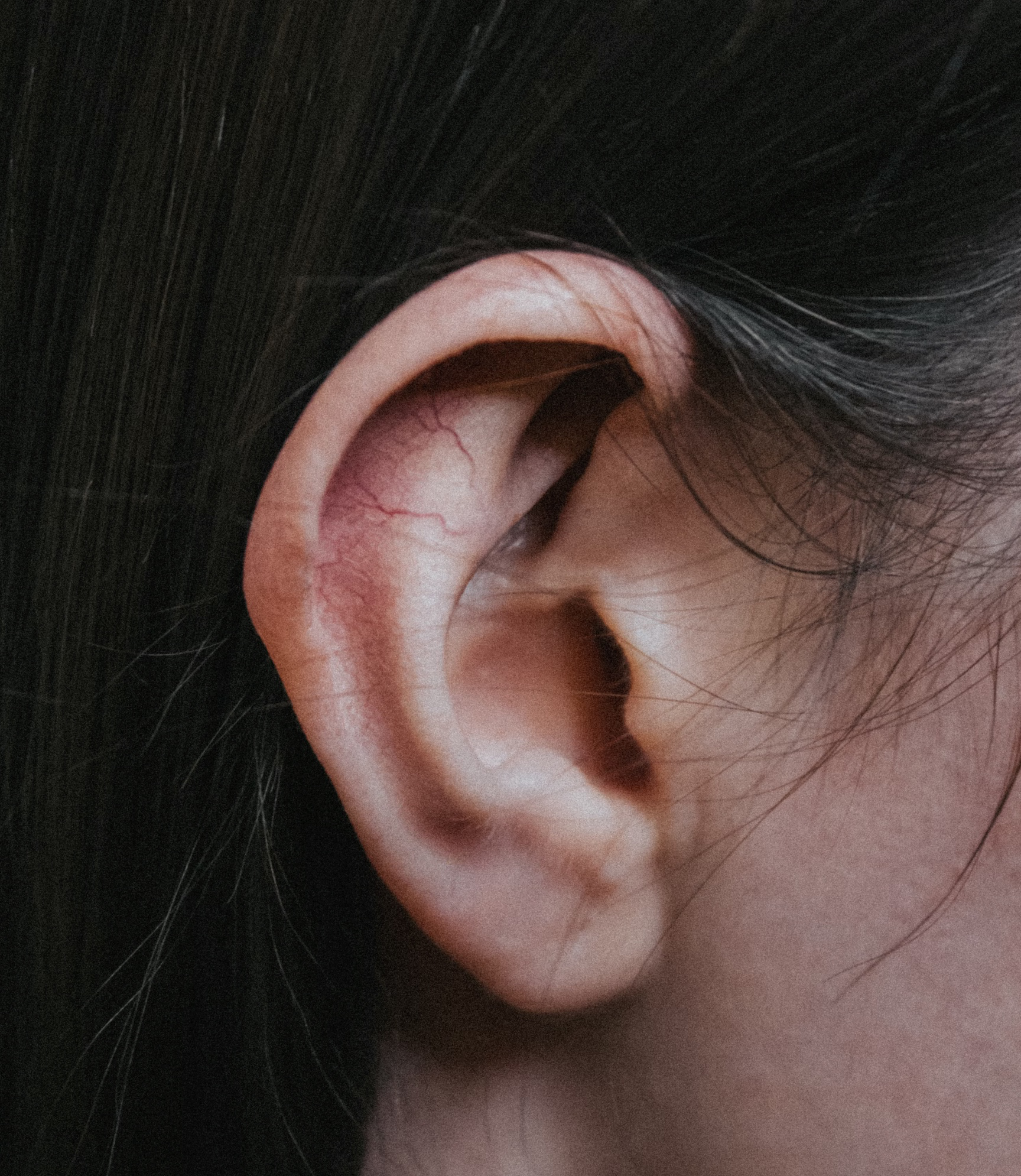 이석증 자가치료법