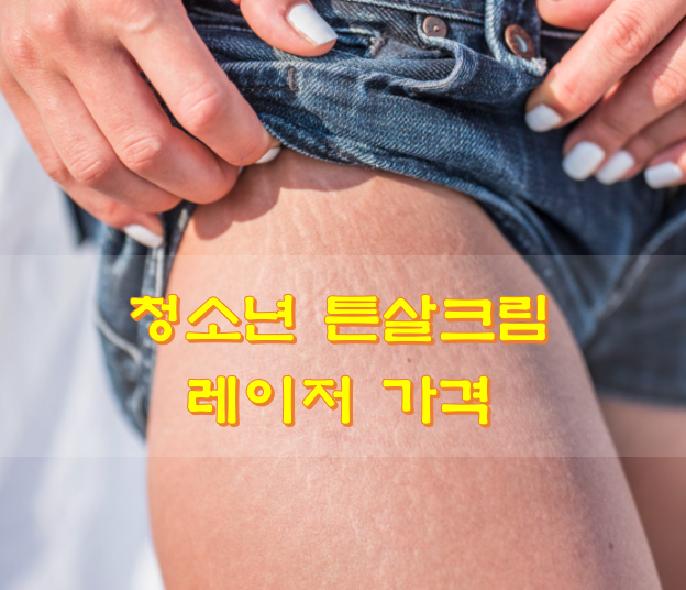 허벅지-튼살