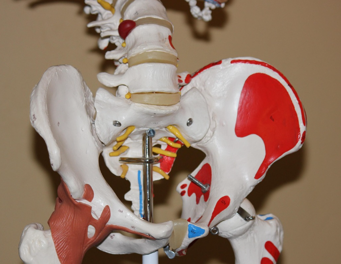 관절염과 수술치료