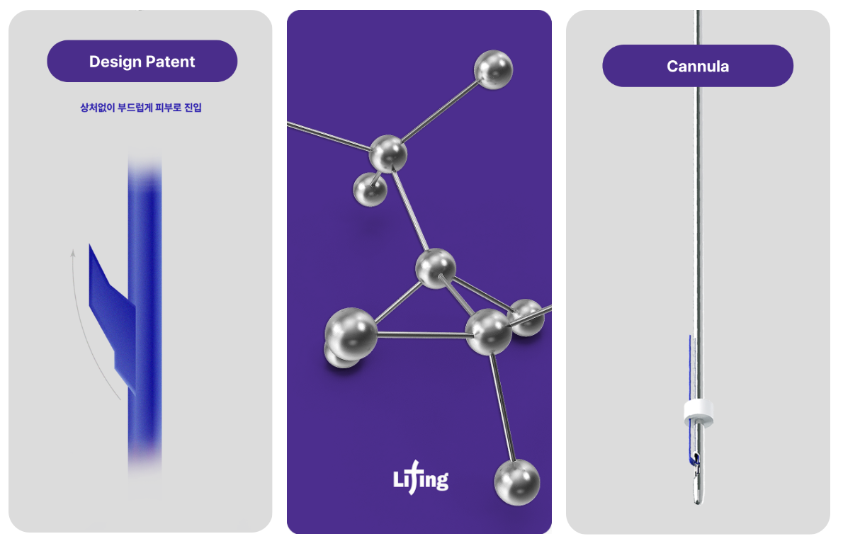 미니팅의 주요 특징