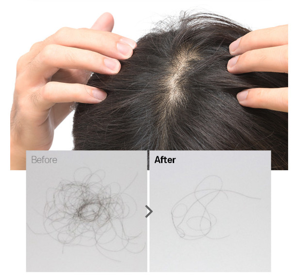 그래비티 샴푸, 모발 볼륨과 탈모 고민을 한 번에 해결!