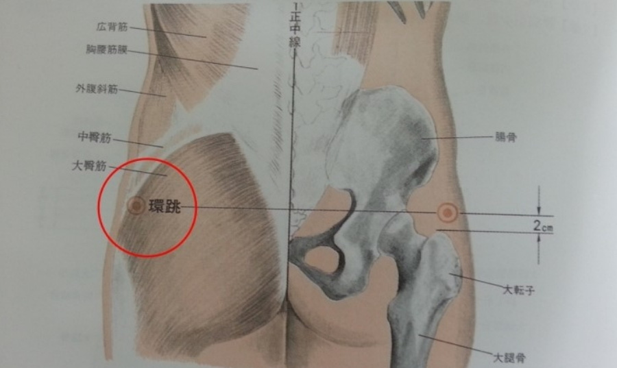 인체의 365혈 중에서 엉덩이 부분에 위치를 한 환도 경혈을 근육과 뼈를 그린 그림에 표시를 한 이미지 사진