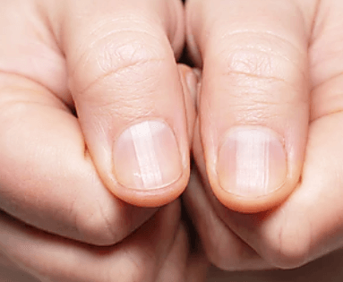 양쪽-엄지-손가락