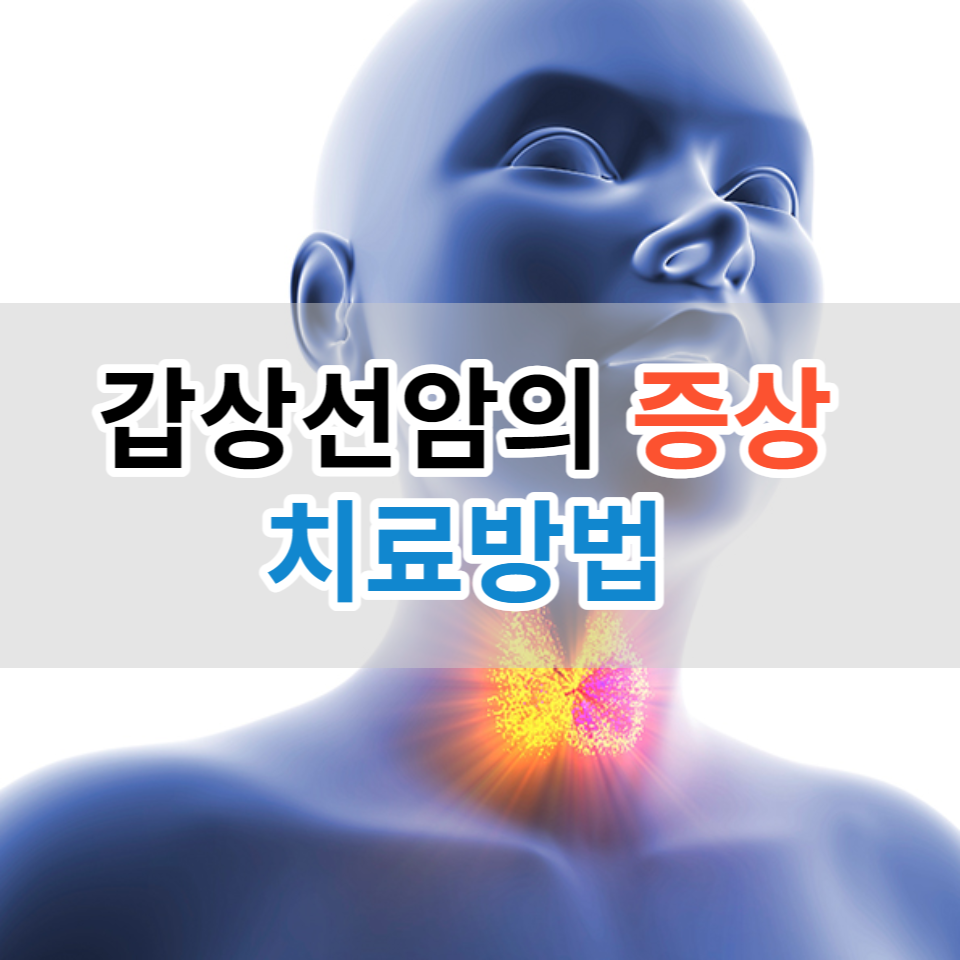 갑상선암