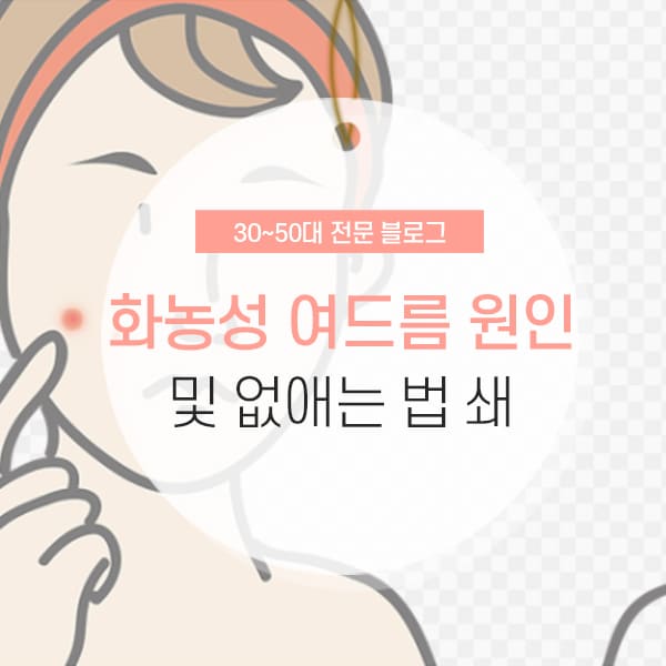 화농성 여드름 없애는 법 및 원인 소개