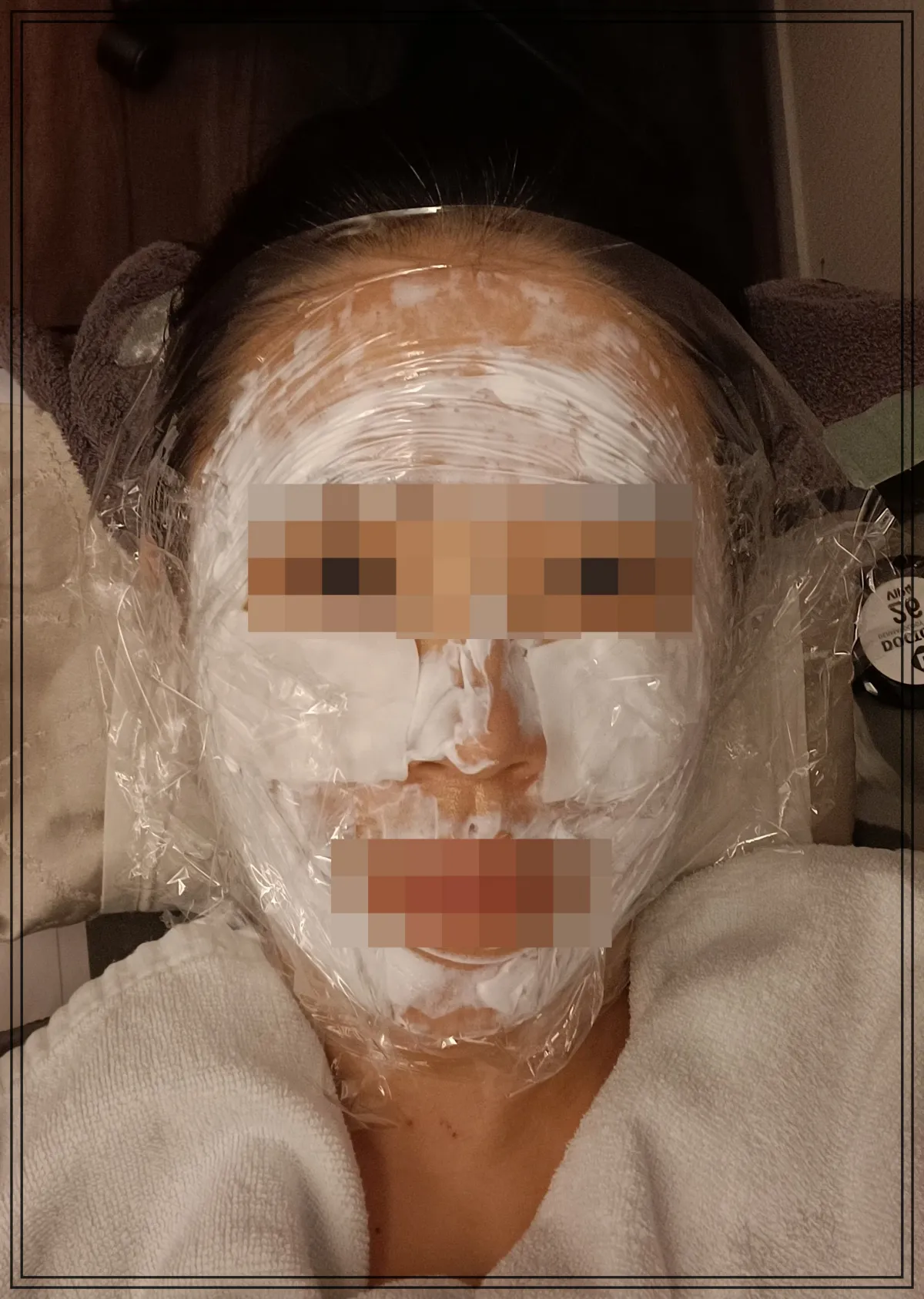 써마지-시술전-마취크림-도포