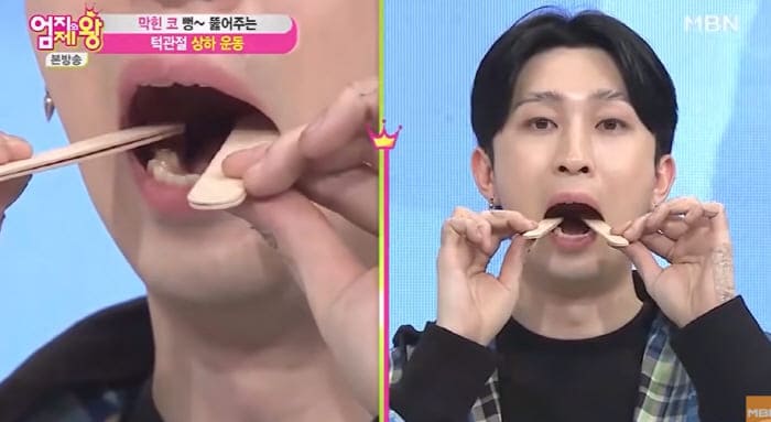 턱관절장애치료법