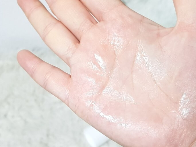 다한증 치료 및 증상&amp;#44; 진단&amp;#44; 원인 (겨땀&amp;#44; 전신&amp;#44; 수족 다한증)