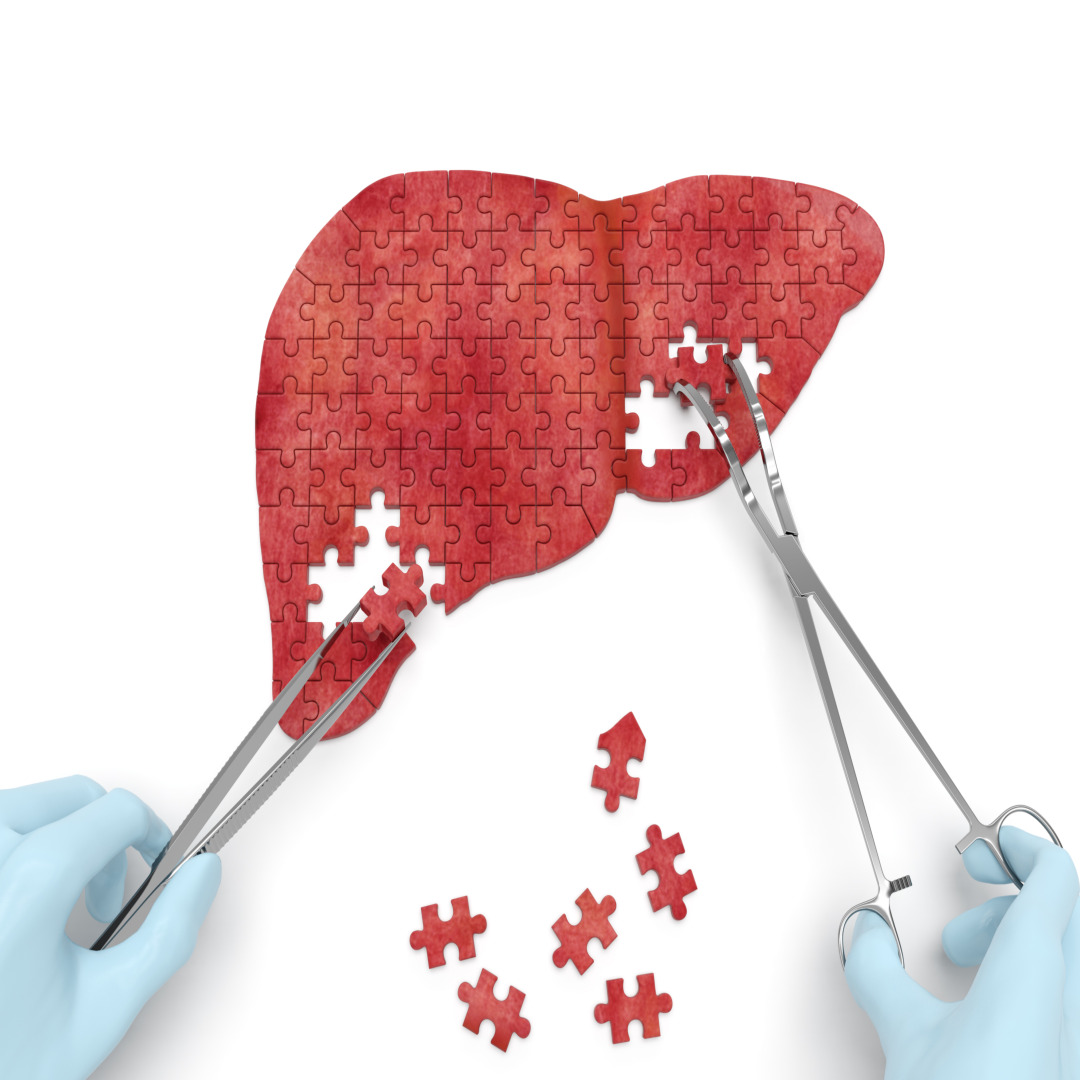 간기능 정상수치 치료법 생활습관