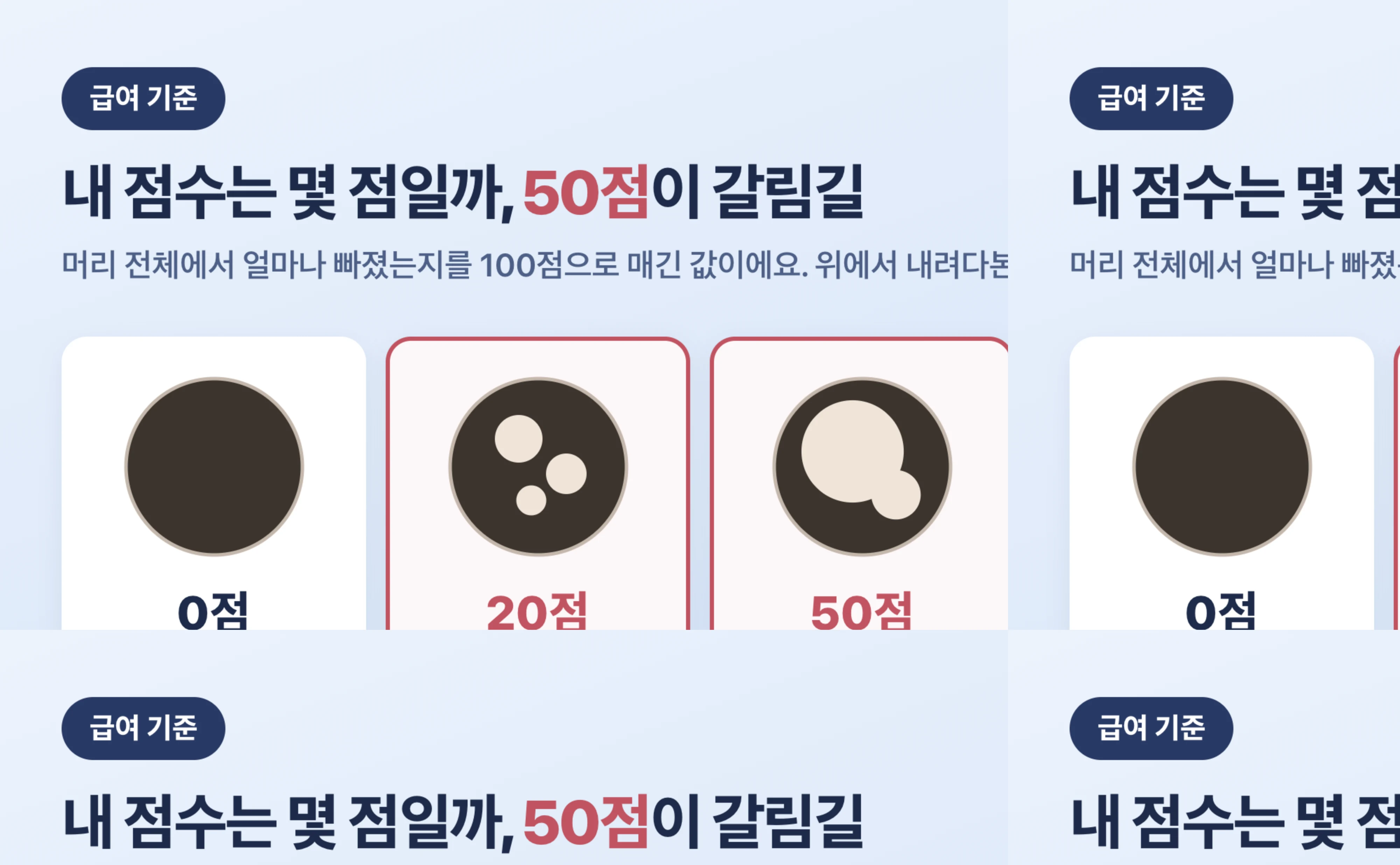 SALT 점수별 두피 상태 개념도. 0점 탈모 없음, 20점 두피 20%, 50점 두피 절반, 80점 두피 80%
