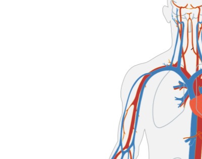 관상동맥 석회화 증상