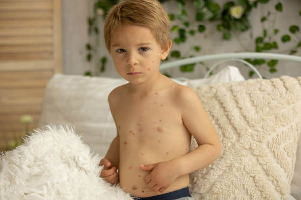 패인 수두 자국, 어떻게 없앨까? 효과적인 방법과 병원 선택 꿀팁