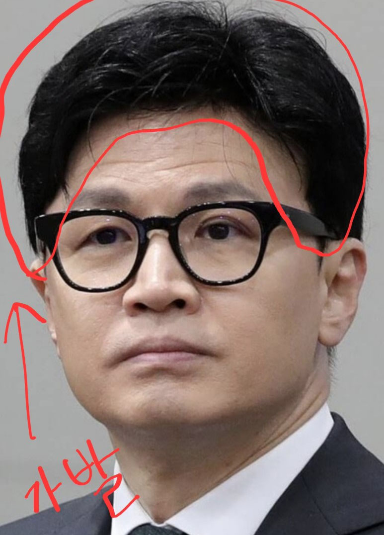 한동훈 대머리