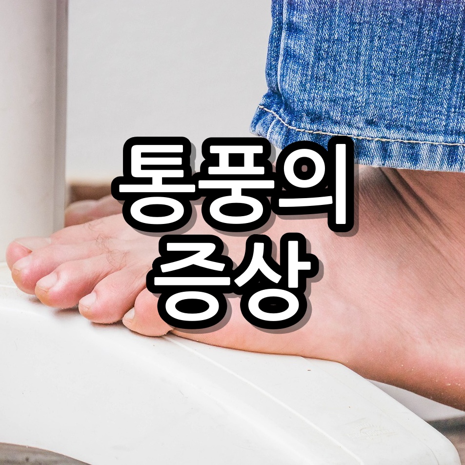 통풍의 증상 발바닥까지 아픈 원인