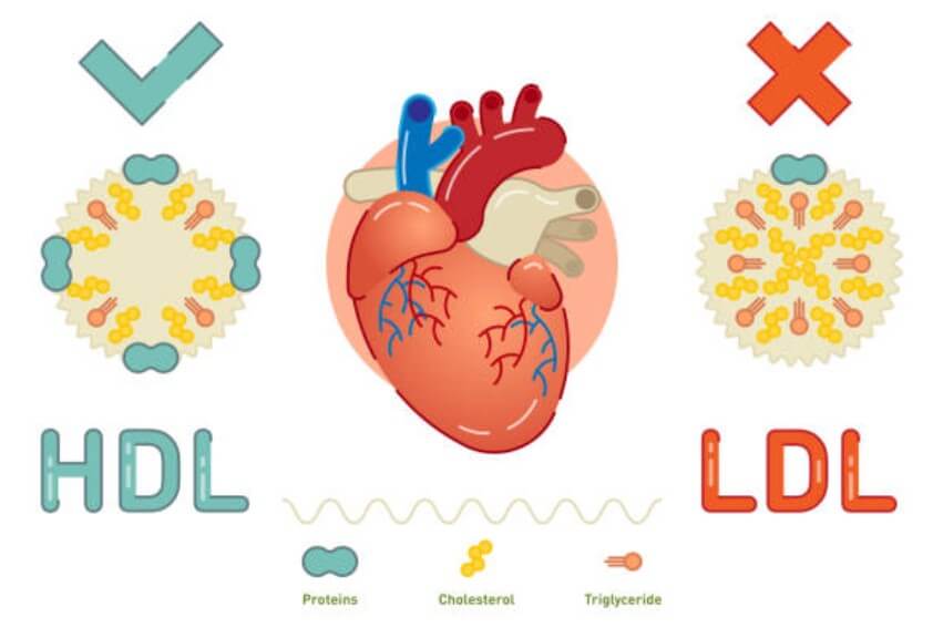 콜레스테롤수치처방