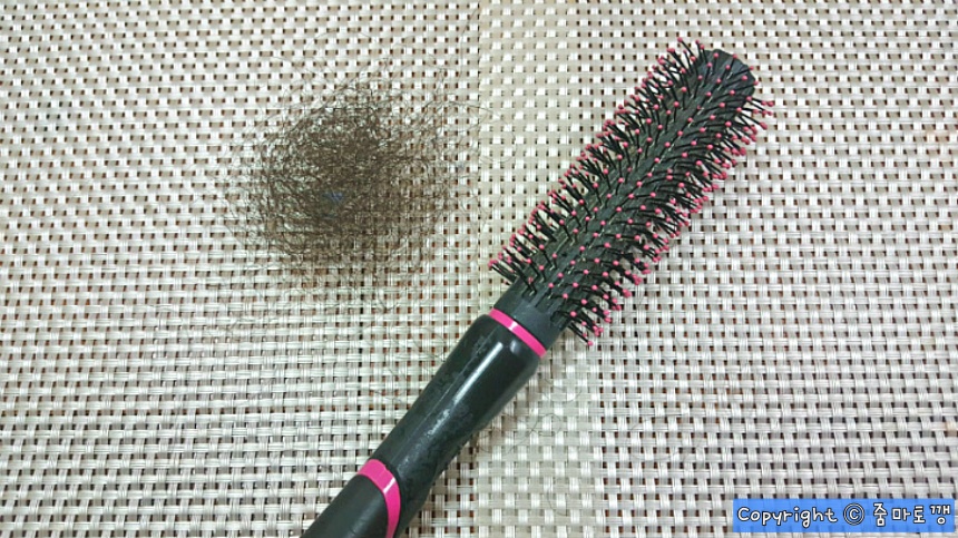 제거된-머리카락