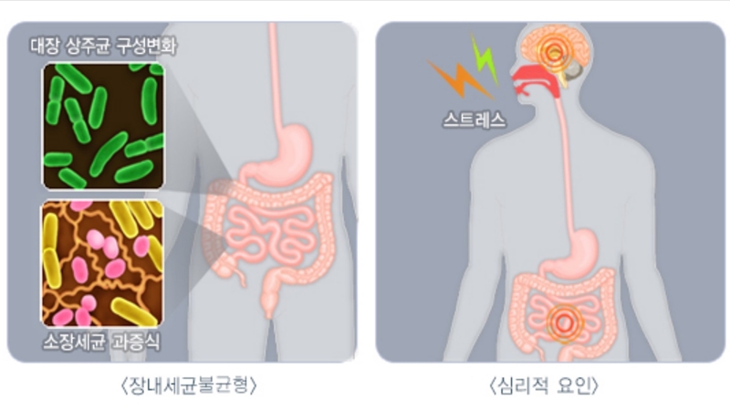 유산균으로_개선하는_방법