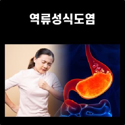 역류성 식도염
